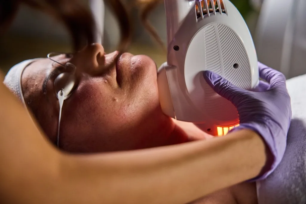 Facial Tightening